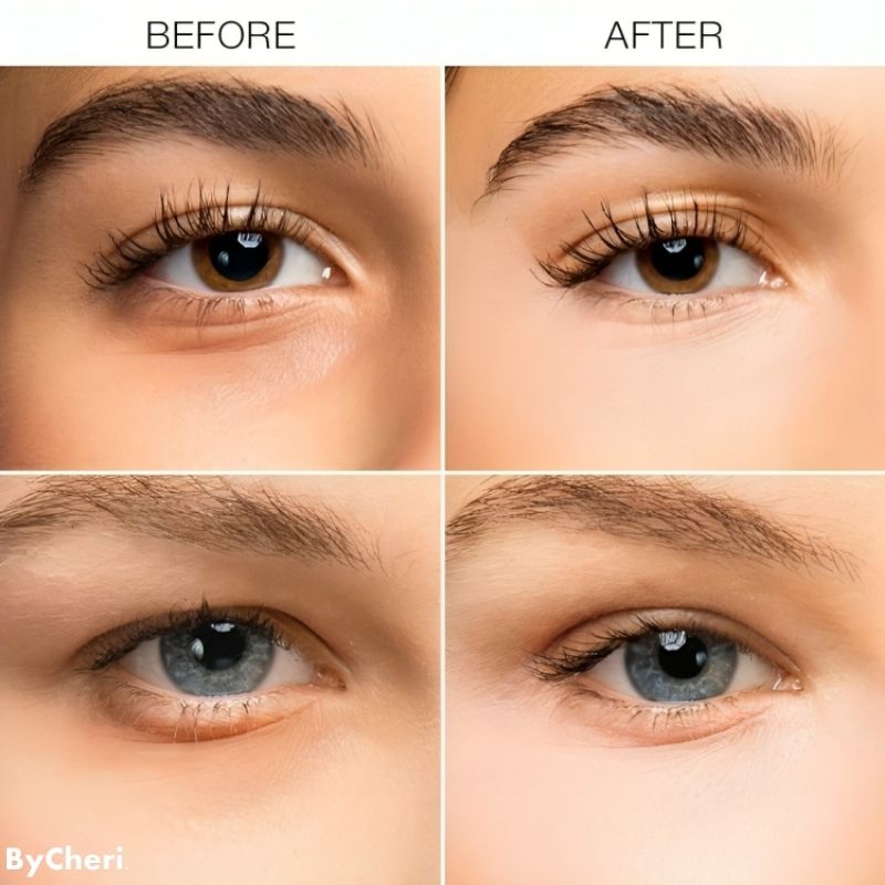 Buy One, Get One Free Today | EyeBright™ | Under-Eye Revitalizer