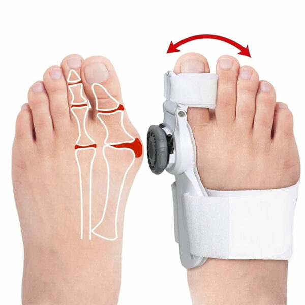 ComfortFlex Bunion Relief Corrector