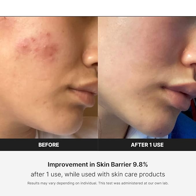 Revitalize Your Skin with the LuminaLift Facial Massager