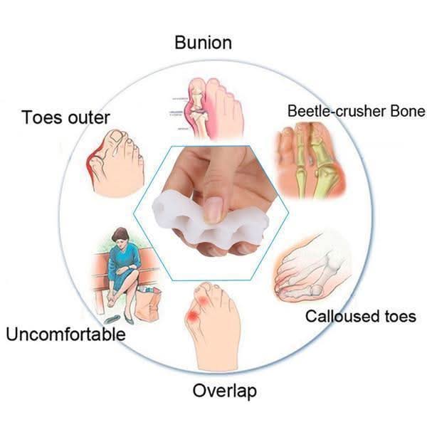 Toe Position Support Foot Corrector for Improved Posture Alignment
