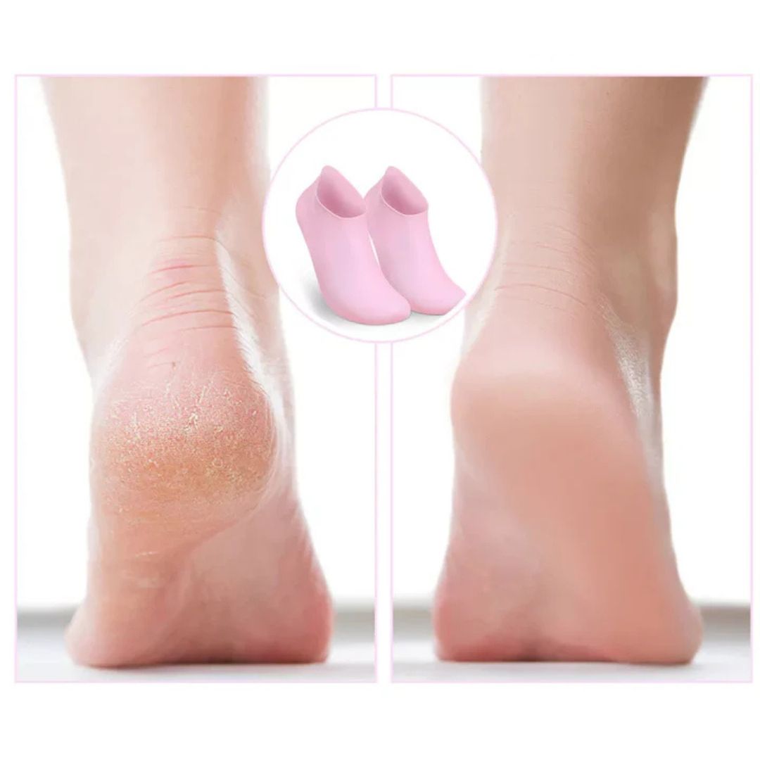 Hydrating Silicone Foot Treatment Socks - 2 Pairs for Soft Heels