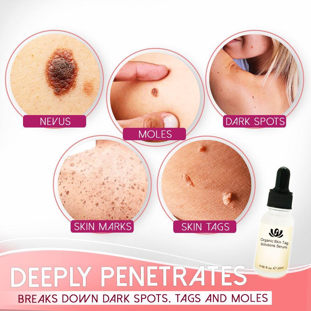 Radiant Skin Solution - Natural Serum for Flawless Complexion