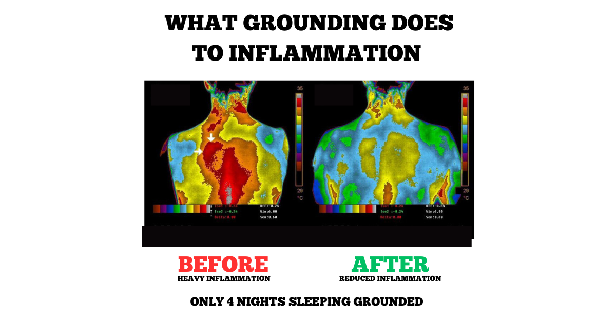 Grounding Sleep Mat for Bed – Under Sheet Pad for Improved Sleep Quality
