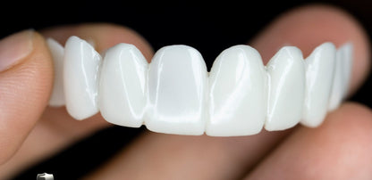 Adjustable White Denture Lens for Direct Smile Enhancement