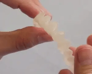 Snap-On Veneers for Upper and Lower Teeth – Quick Natural Smile Solution