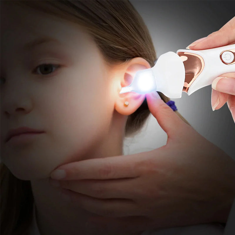 Electric Earwax Removal Tool - 5 Functions
