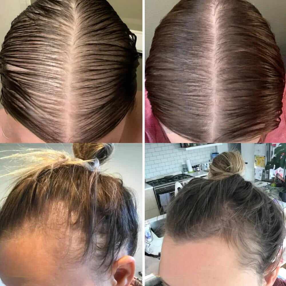 Nourishing Hair Elixir with 11 Essential Oils | Scalp & Hair Care | Vegan, Silicone-Free, Paraben-Free | Suitable for All Hair Types