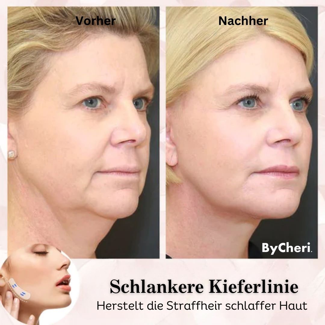 Achieve a Youthful Glow with the Instant Lift Tape Set
