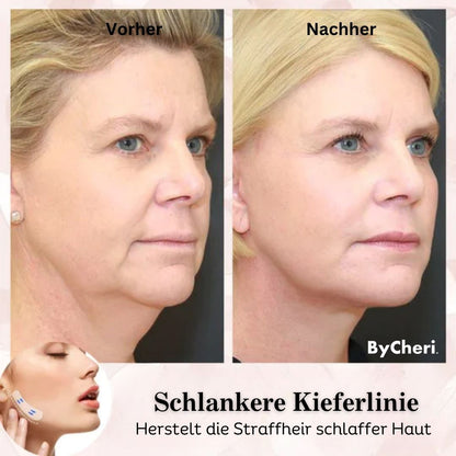 Achieve a Youthful Glow with the Instant Lift Tape Set