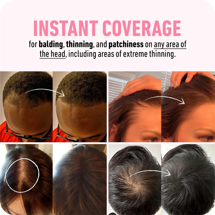 Revive Your Hairline | VolumeBoost Powder Duo