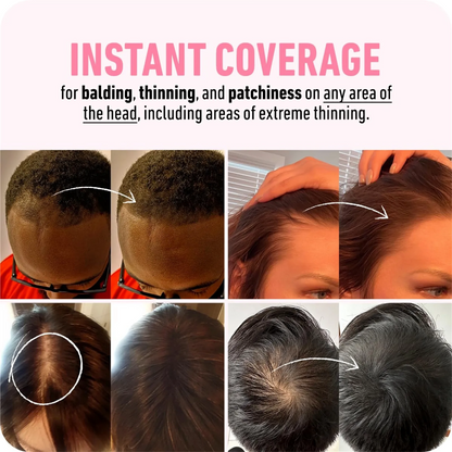 Revive Your Hairline | VolumeBoost Powder Duo