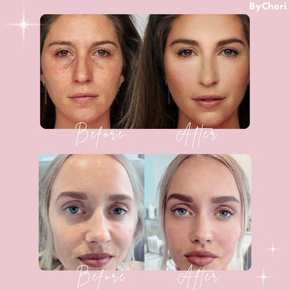 Buy One, Get One Free Today | EyeBright™ | Under-Eye Revitalizer