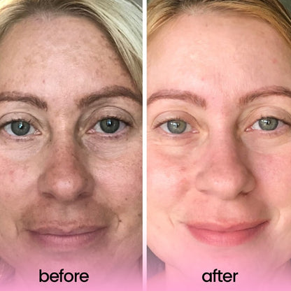 Get One Free Today | RadianceBoost™ | Achieve Luminous Skin Instantly!