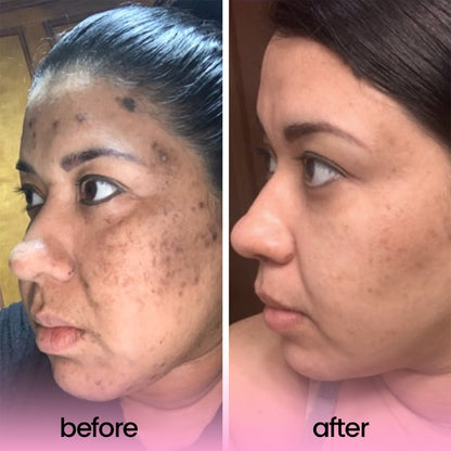 Get One Free Today | RadianceBoost™ | Achieve Luminous Skin Instantly!