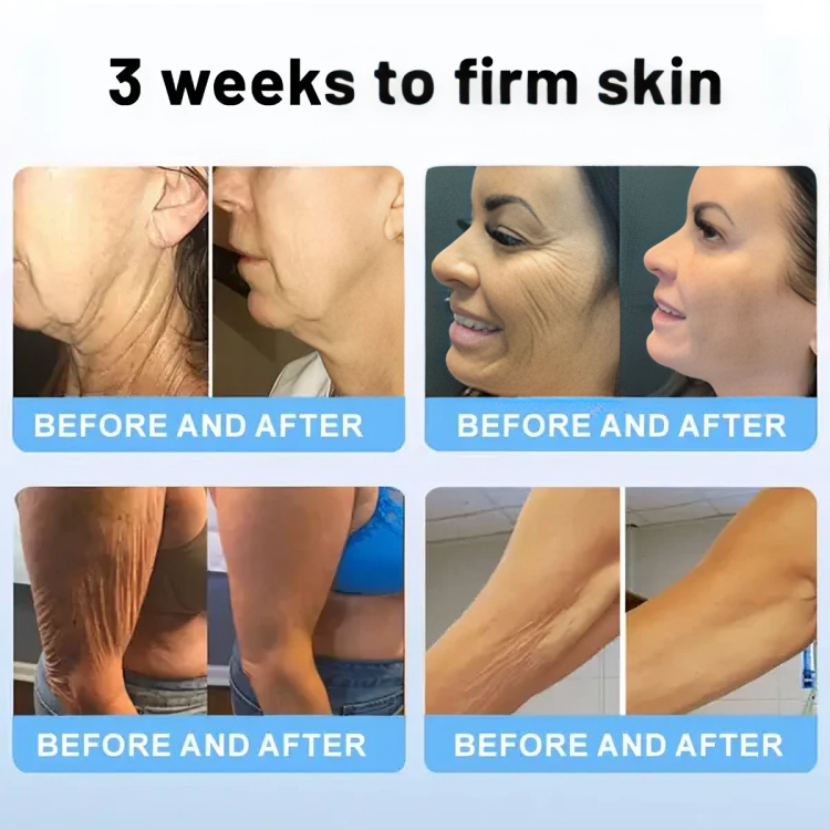 Buy 1 Get 1 Free Today | SkinRevive Stick | Your Secret to Firmer, More Elastic Skin!