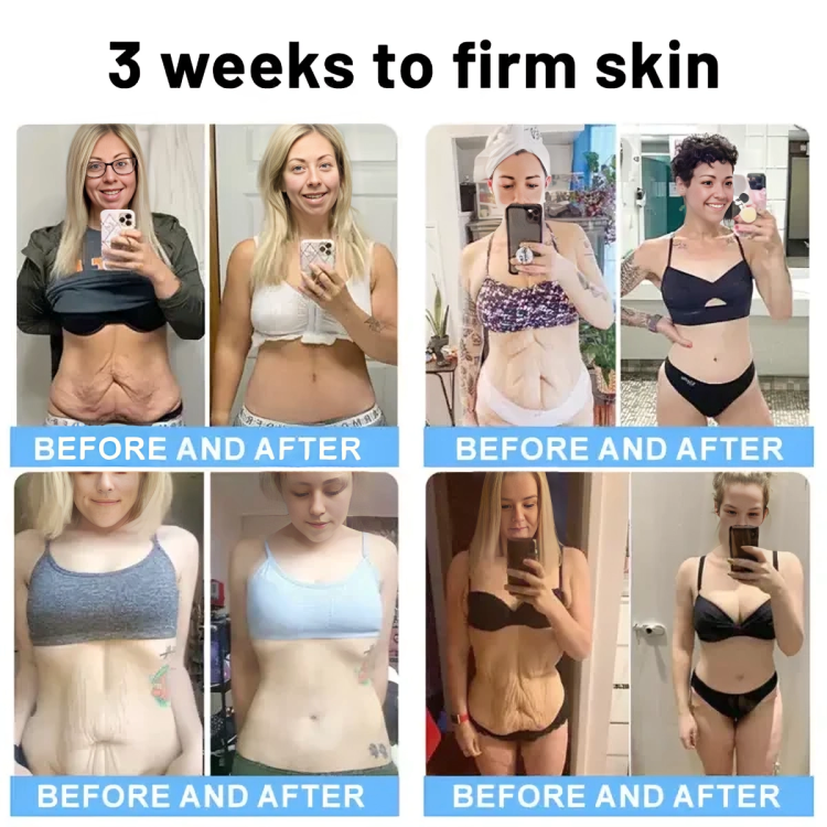 Buy 1 Get 1 Free Today | SkinRevive Stick | Your Secret to Firmer, More Elastic Skin!
