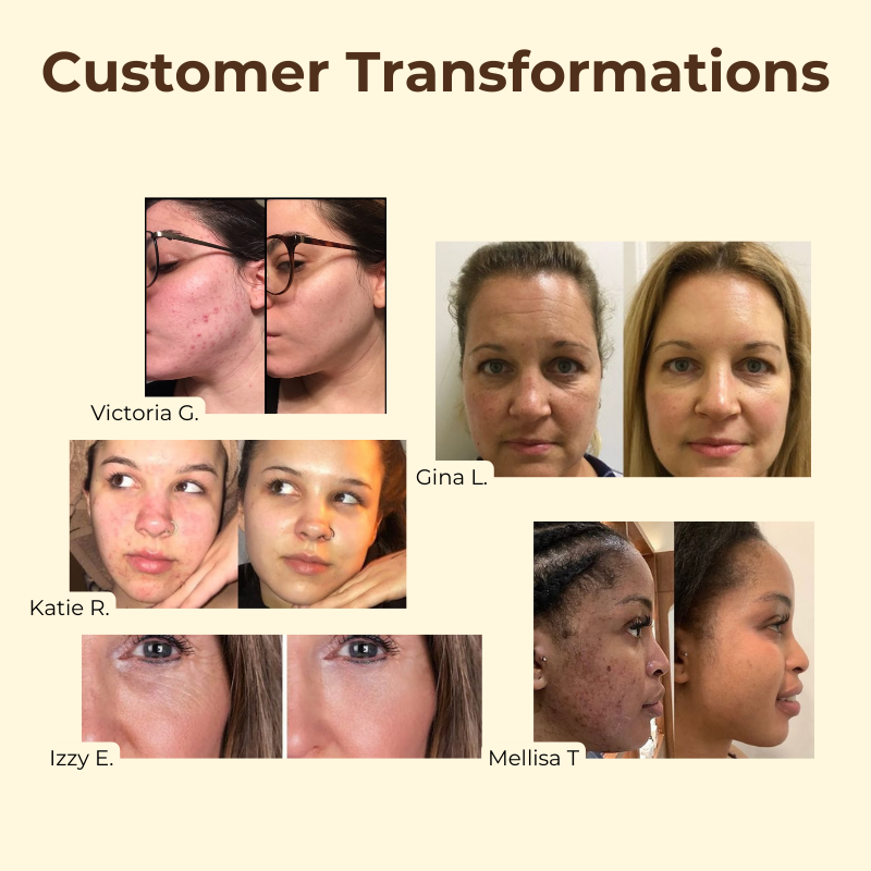 Buy One, Get One Free Today | SkinHarmony™