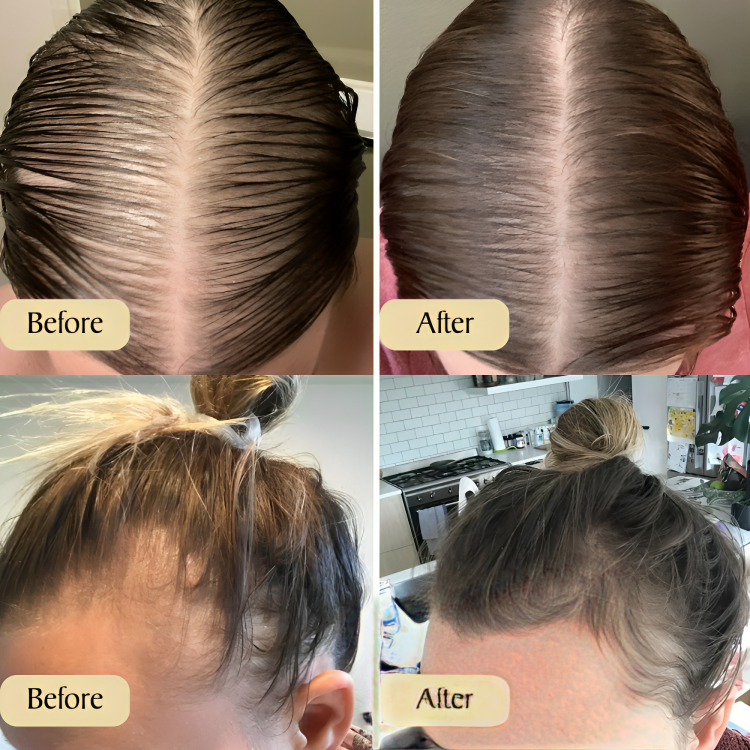 Buy One Get One Free Today | HairVital™ | Achieve Beautiful & Healthy Hair!