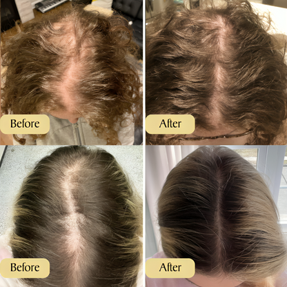 Buy One Get One Free Today | HairVital™ | Achieve Beautiful & Healthy Hair!