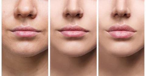 Achieve Fuller Lips Quickly with Lip Plumper Serum