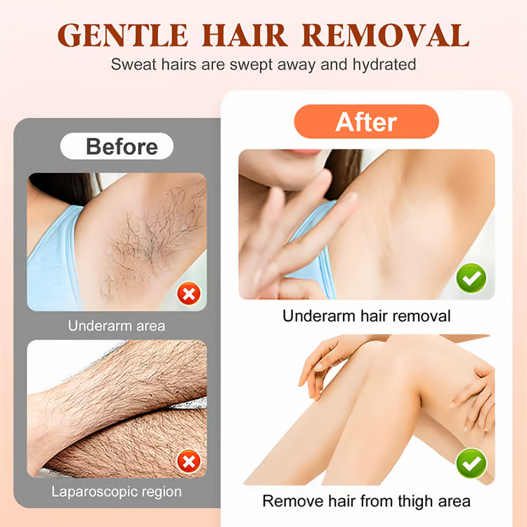 SmoothSkin™ Hair Removal Set - Effortless & Gentle Care