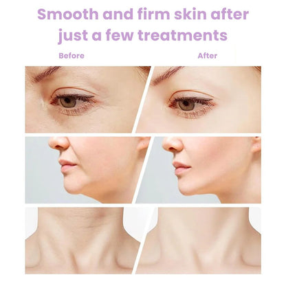 Revitalizing Facial & Neck Massager | Ion Cleansing, Heat & LED Therapy