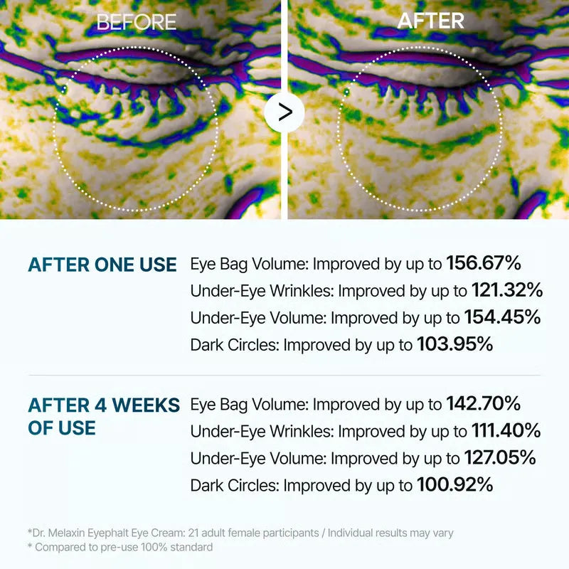 BrightEye™ Revitalizing Eye Cream - 1+1 Free Offer