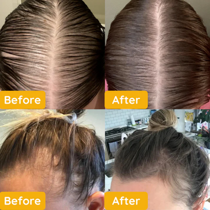 Revitalize Your Hair with Naturalis™ – Wake Up to Fuller Locks