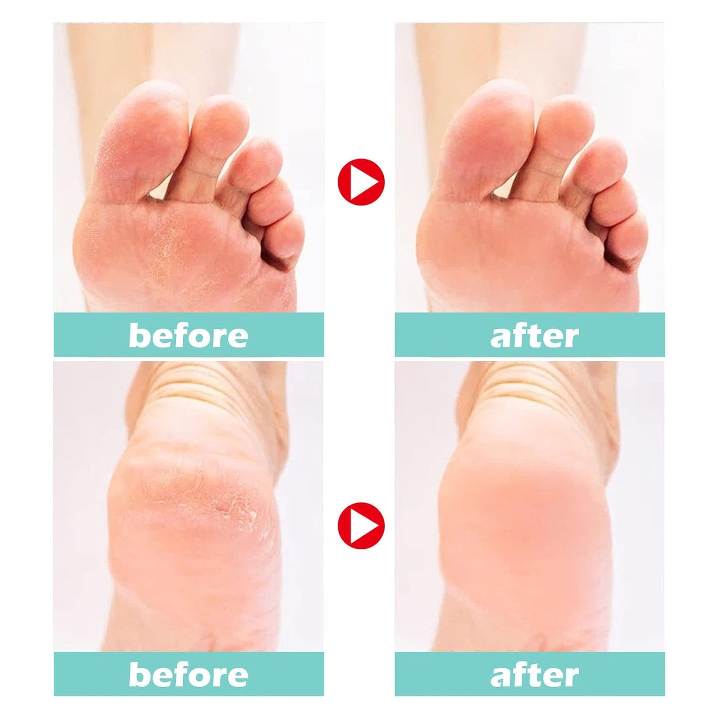 Revitalizing Foot Therapy Cream – Nourishes and Protects Dry Skin