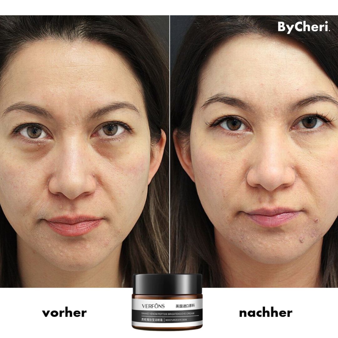 Revitalize Your Eyes | AgelessGlow Eye Treatment Cream