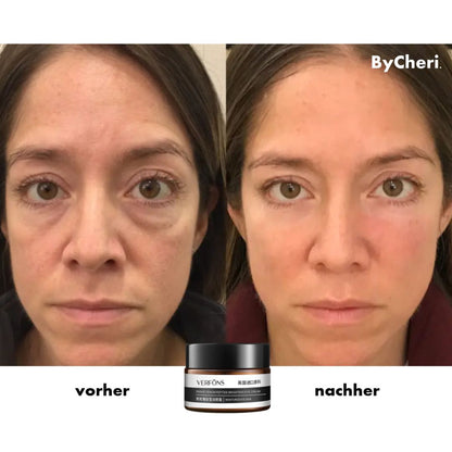 Revitalize Your Eyes | Youthful Glow Eye Cream Bundle
