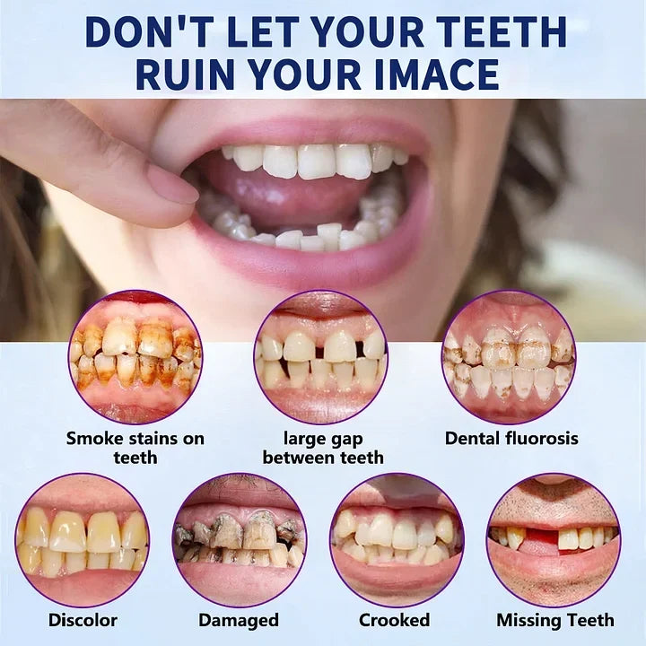 FlexiSmile Complete Denture System for Enhanced Comfort