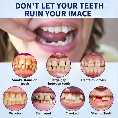 FlexiSmile Complete Denture System for Enhanced Comfort
