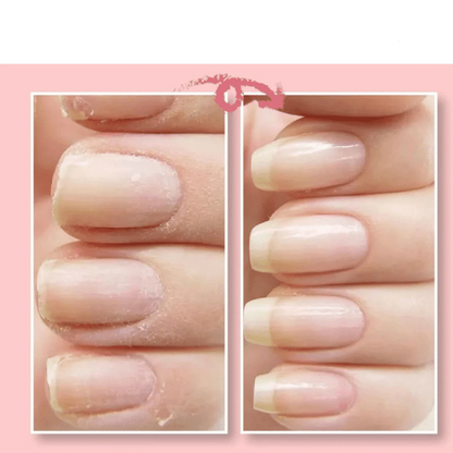 Nail Revive Repair Gel for Stronger, Healthier Nails