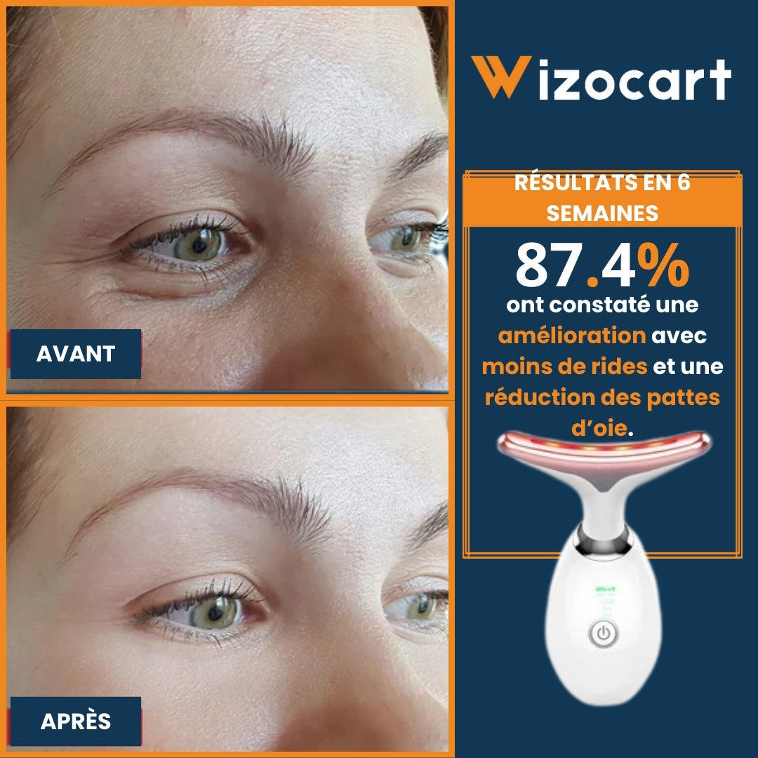 Facial Device for Wrinkle Reduction and Skin Lifting – Anti-Aging