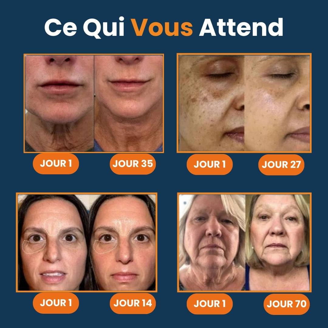Facial Device for Wrinkle Reduction and Skin Lifting – Anti-Aging