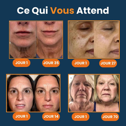Facial Device for Wrinkle Reduction and Skin Lifting – Anti-Aging