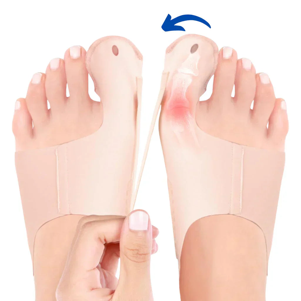 Buy One Get One Free | AlignaFeet – For Naturally Beautiful & Pain-Free Feet