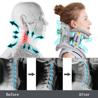 Adjustable Cervical Traction Device for Neck Pain Relief and Tension