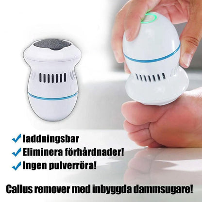 Callus Remover for Smooth Feet