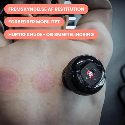 Revitalizing Electric Cupping Massage Device