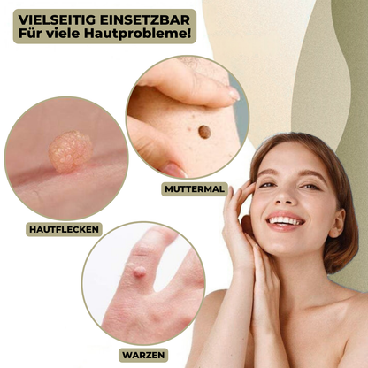 SkinClear Wart and Mole Remover | Gentle and Effective | For Face and Body