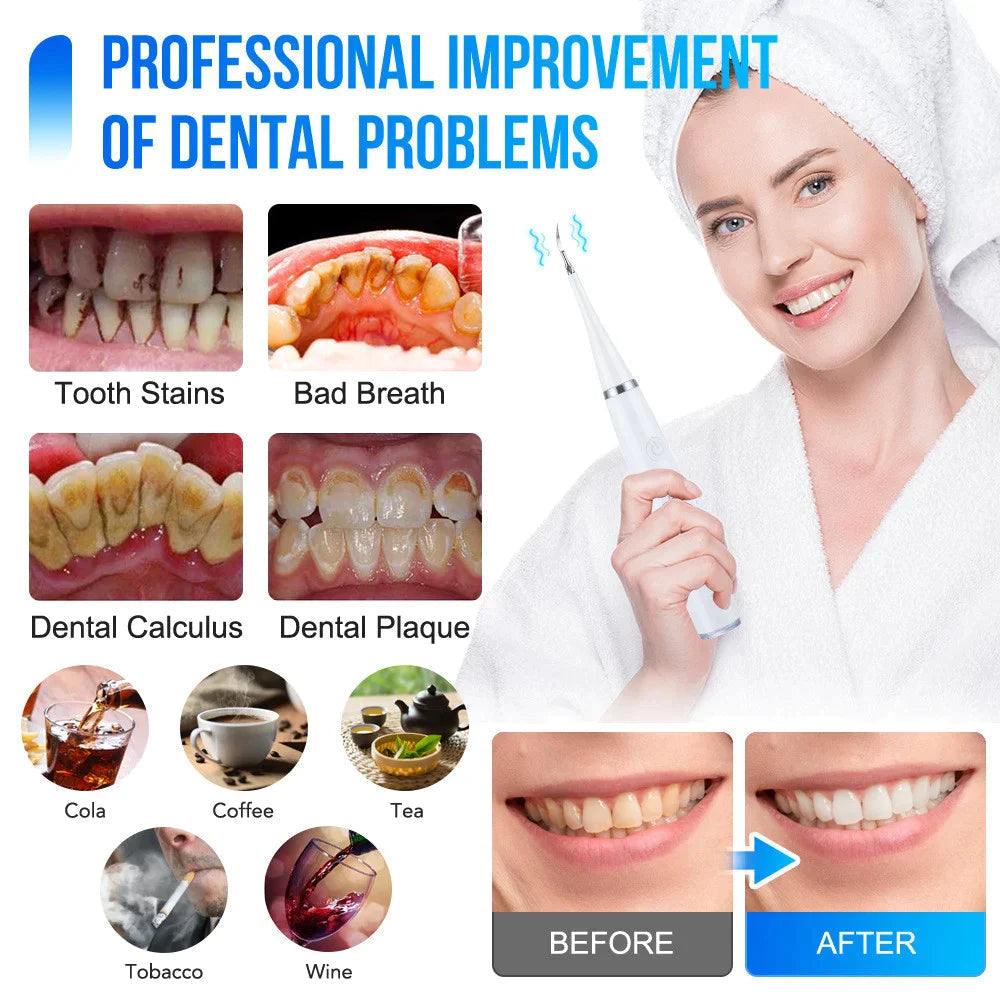 SonicSmile Pro: Ultrasonic Tooth Cleaner with 5 Settings