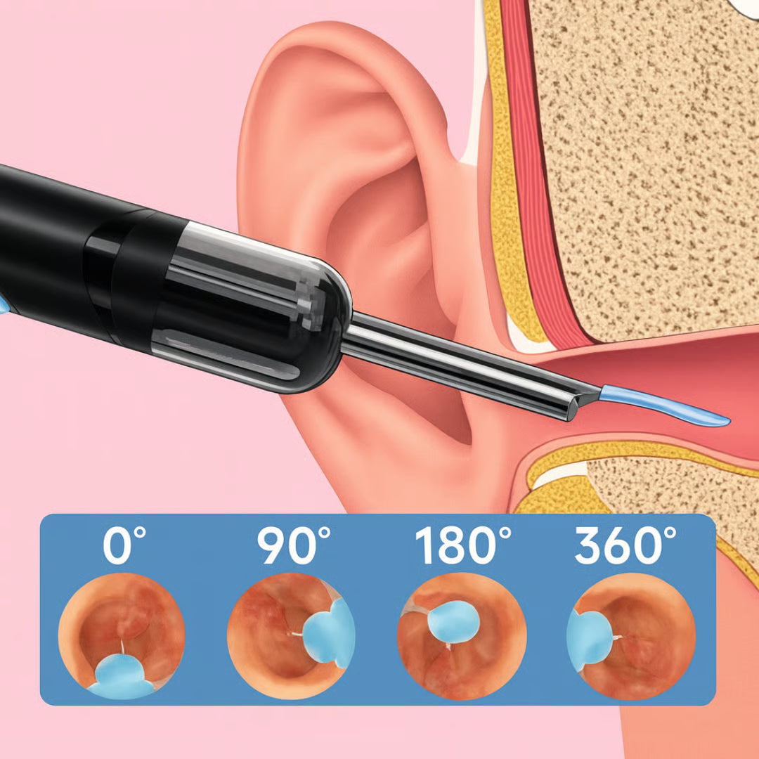 Ear Cleaner with Camera - Clean and healthy ears