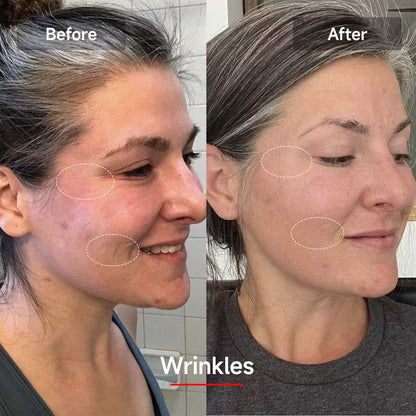 RadiantGlow LED Skin Rejuvenation Mask