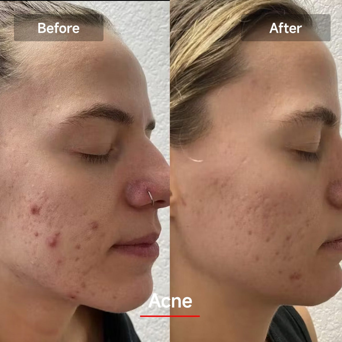 RadiantGlow LED Skin Rejuvenation Mask