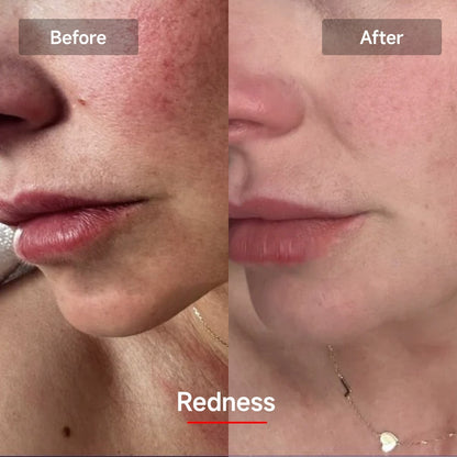 RadiantGlow LED Skin Rejuvenation Mask