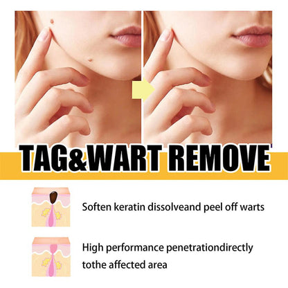 Targeted Skin Treatment Pen with Precision Applicator 3 ml | Fast-Drying Serum for Flawless Skin