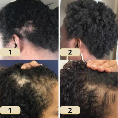 Nourishing Hair Elixir with 11 Essential Oils | Scalp & Hair Care | Vegan, Silicone-Free, Paraben-Free | Suitable for All Hair Types