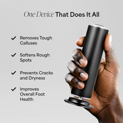 SmoothFeet Pro Electric Callus Remover for Ultimate Foot Care